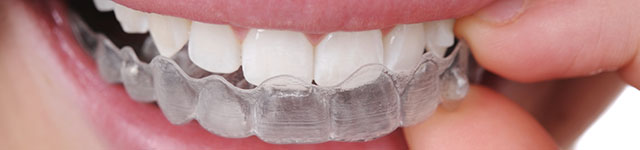Orthodontics Treatment AXIS Dental