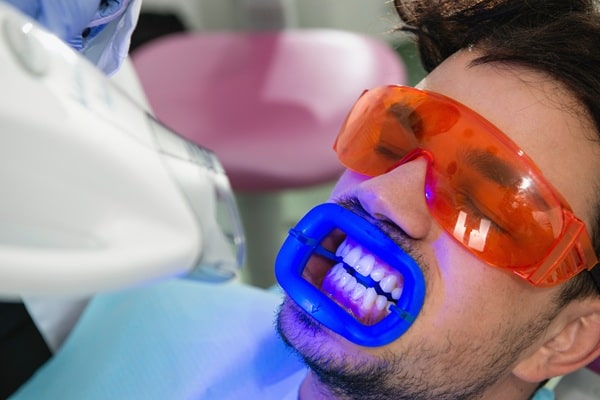 how-teeth-whitening-works-at-axis-dental