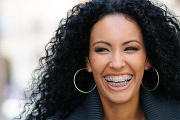 Adult Orthodontics to Align or Straighten Teeth