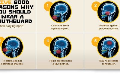 Mouthguards in Sports… Are you keeping your smile safe?